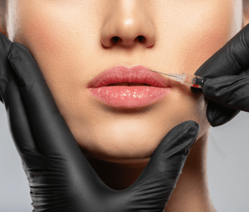 ICON Signature Lips Treatment in Clearwater