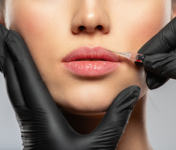 ICON Signature Lips Treatment in Clearwater, FL | iConcierge Medspa