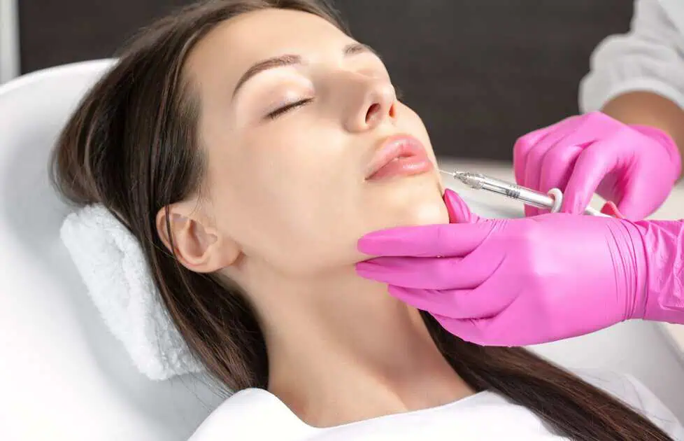 Lip Filler in St Petersburg FL by iConcierge Medspa