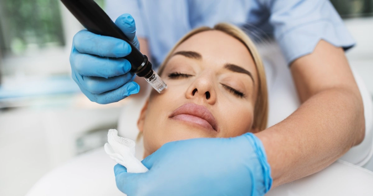 Women taking Microneedling In St Petersburg