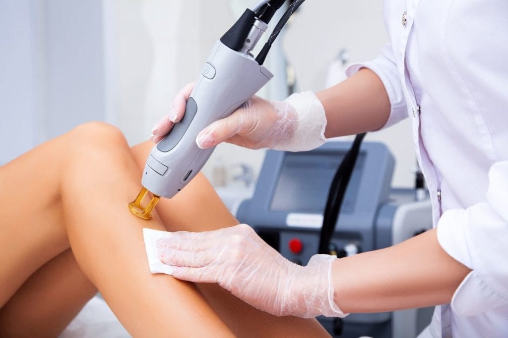 Laser Hair Removal in Clearwater
