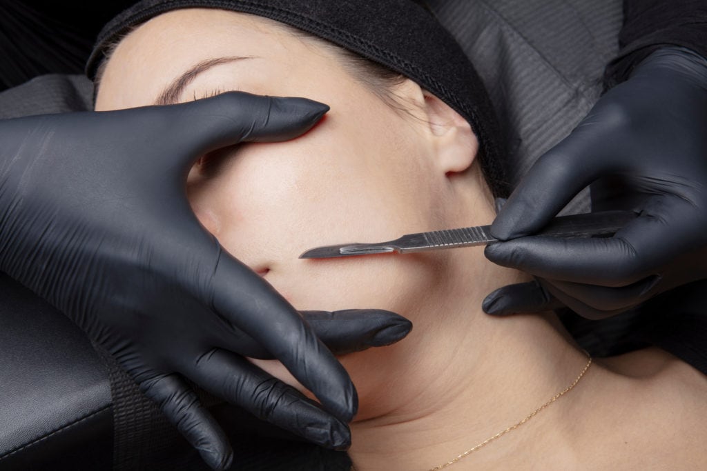 Dermaplaning in St. Petersburg, FL | iConcierge Medspa