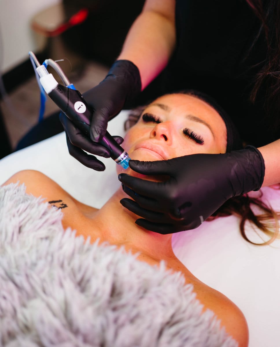 Hydrafacial in St. Petersburg, FL | iConcierge Medspa