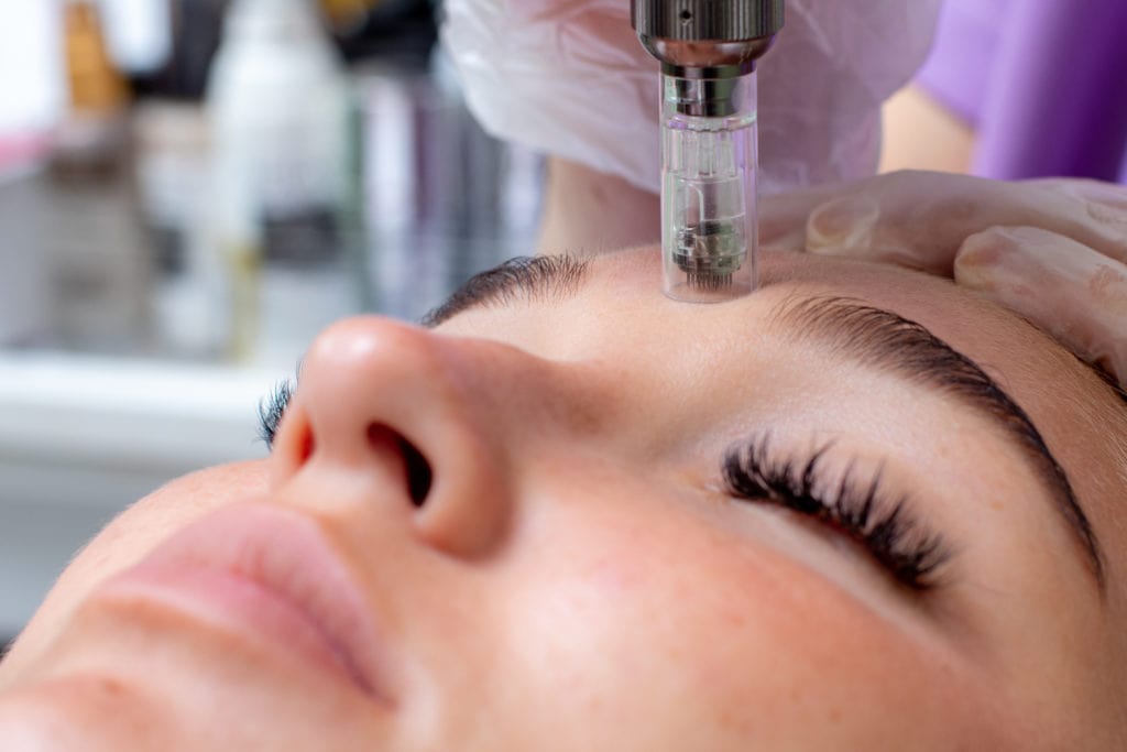Microneedling in St. Petersburg, FL | iConcierge Medspa