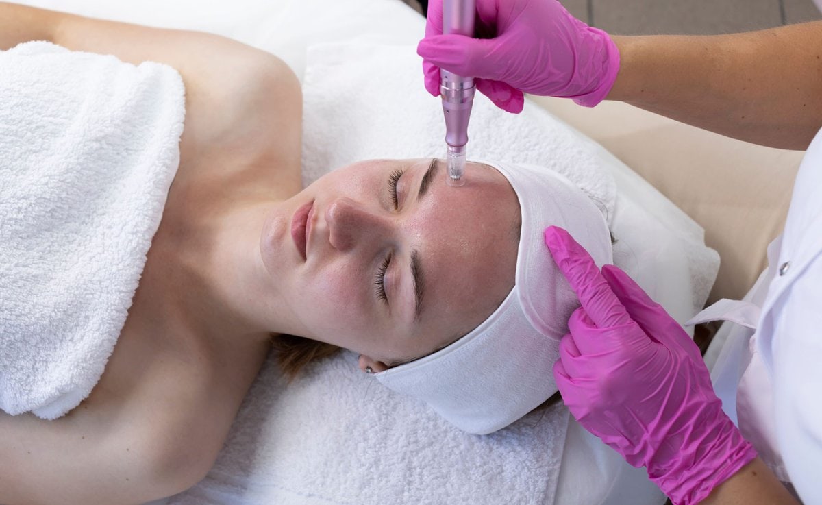 Microneedling in St. Petersburg, FL | iConcierge Medspa