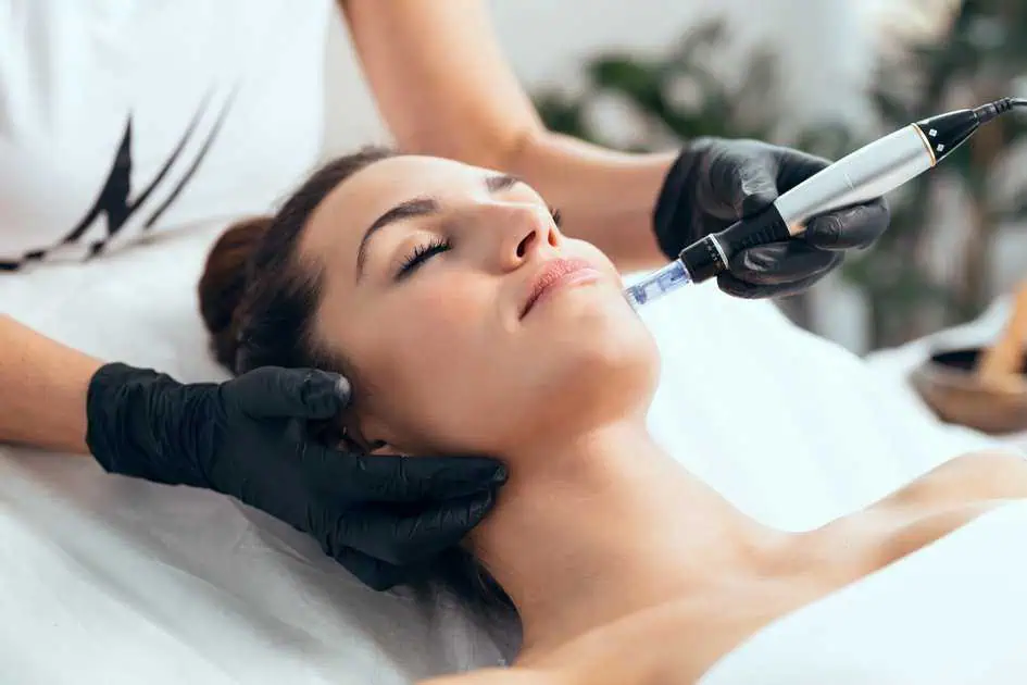 Microneedling Treatment in St. Petersburg, FL by iConcierge Medspa